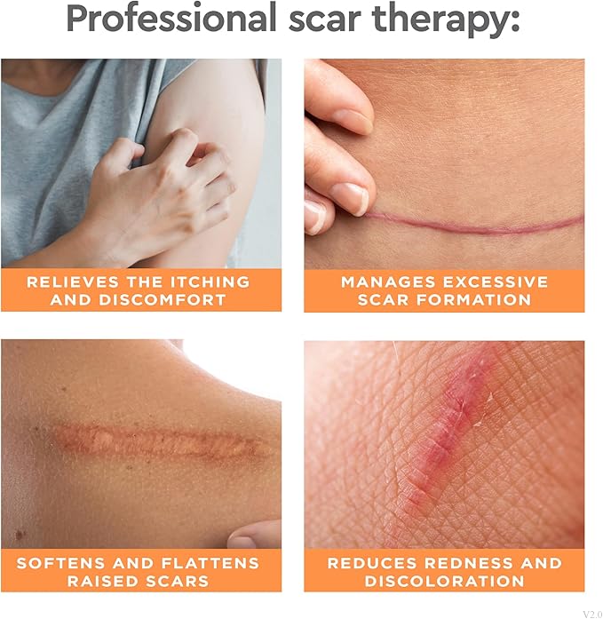 Strataderm Professional Scar Therapy Gel | Old and New Scars from General Surgery, Trauma, Wounds, Burns, Bites, Acne & Skin Disease | Reduces Redness, Discoloration, Discomfort & Itch | 5g (0.17oz)