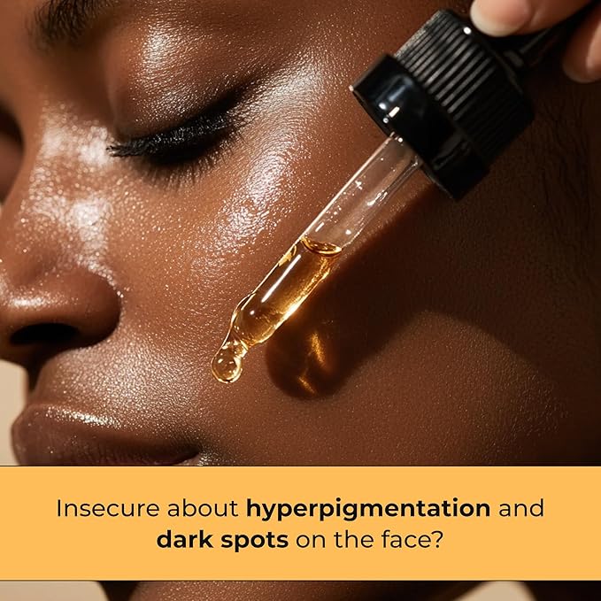 Glo Melanin Dark Spot Remover for Face - Dark Spot Corrector Serum with Vitamin C - Reduces Discoloration and Hyperpigmentation