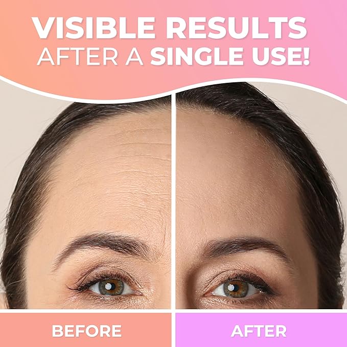 CLEVERFY Silicone Forehead Wrinkle Patches - Pack of 2 Reusable Silicone Patches for Face Wrinkles