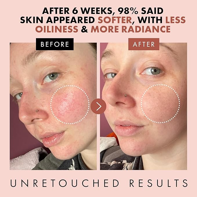 Eclat Skincare Rose Water Toner – Hydrating Toner for Face - Rosewater with Hyaluronic Acid & Aloe Vera - Alcohol Free & Skin Soothing Formula - Rejuvenating & Calming Facial Skin Care