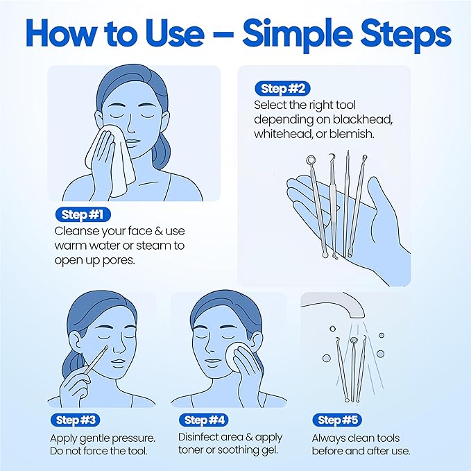 Blackhead Remover Extractor Pimple Popper Tools - Comedone Acne Zit Cleaner Kit for Nose Facial Pore Press Tool for Face Blemish Whitehead Popping Extractors, Stainless Steel 4 Pc Set by Krisp Beauty