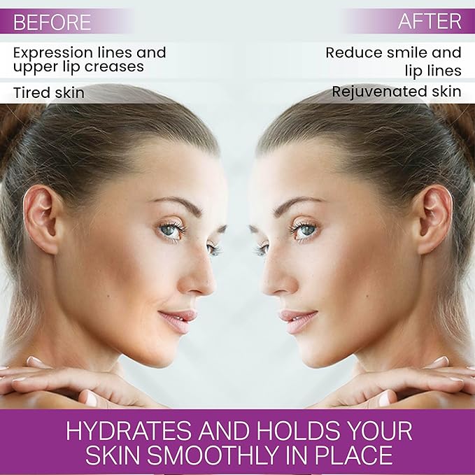 Furlesse Lip-Sticks Wrinkle Patches, Overnight Anti-Wrinkle Anti-aging