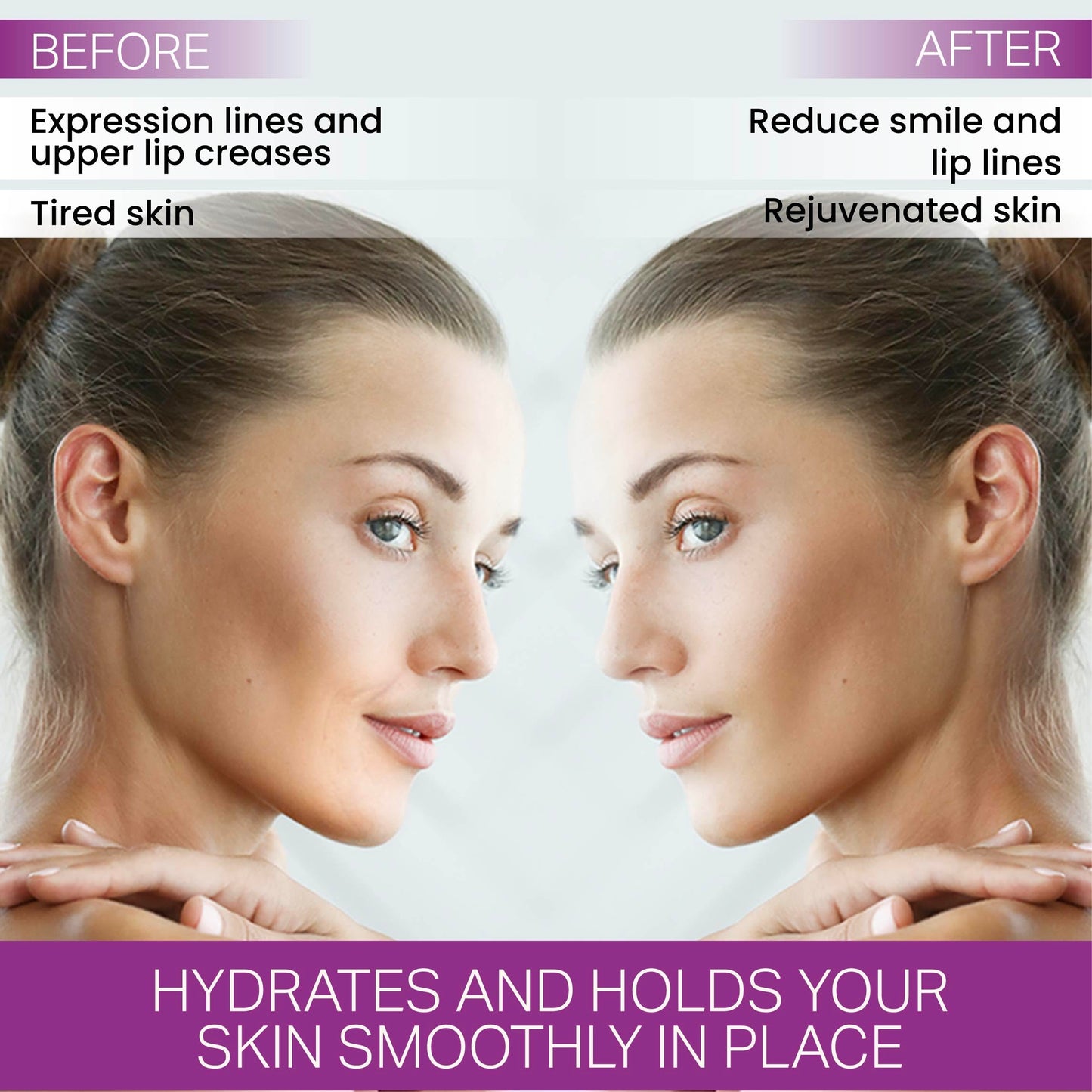 Furlesse Lip-Sticks Wrinkle Patches, Overnight Anti-Wrinkle Patches for Smile Lines, Fine Lines, and Expression Lines, Non-invasive Lip Patches, Anti-aging Skincare, 120 Patches, 30-Day Use