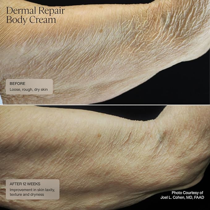 Senté Dermal Repair Body Cream | Restore Skin's Barrier | Soothes Sensitive Skin | Promotes New Collagen Production for Firmer Skin | 6 Fl Oz