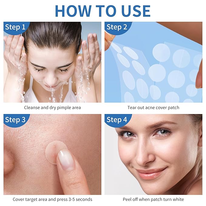 Pimple Patches for Face, 3 Size 510 Counts Hydrocolloid Acne Patches for Covering Zits and Blemishes, Spot Stickers with Salicylic Acid, Tea Tree Oil & Calendula Oil(8mm,10mm,12mm)
