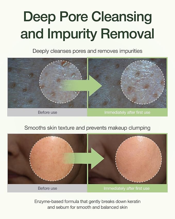 CENTELLIAN 24 Madeca Enzyme Cleansing Powder (2.03fl oz) - Gentle Daily Exfoliating Face Cleanser & Mask for Smooths Skin, Reduces Oil & Remove Impurities, Korean Skin Care. TECA, Mint Powder