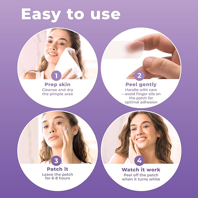 Large Pimple Patches for Face (20 Pack), Treat Blemishes Overnight, Hydrocolloid Acne Patch, Hydrocolloid Bandages, Big Pimple Patches, Large Acne Patch