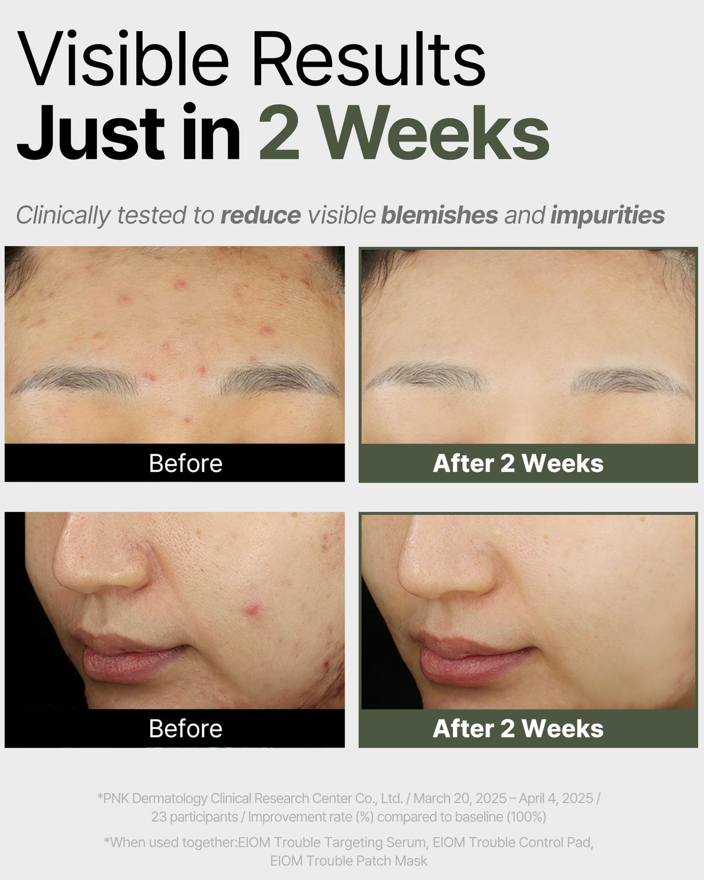 EIOM Trouble Patch Mask | Korean Face Mask – Hydrating & Acne Face Mask for Blemish-Prone Skin, Calming Skincare & Oil Control Sheets (20ml x 4)