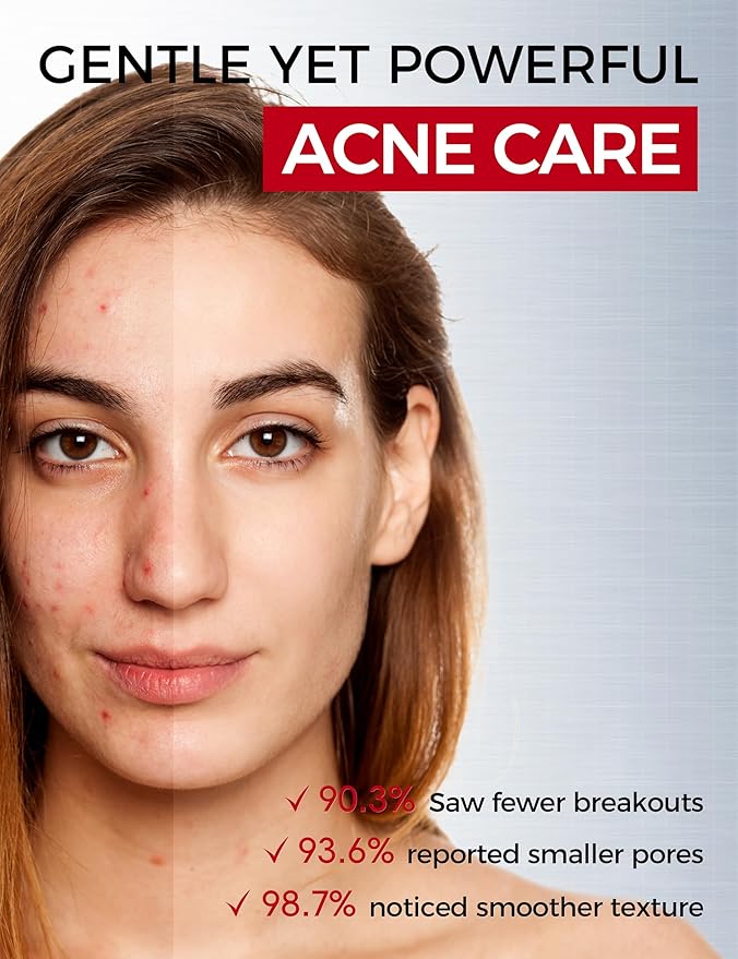 Salicylic Acid Acne Serum – Anti Acne Face Serum with 2% Salicylic Acid, Niacinamide, Centella & PHA – Pore Minimizer, Oil Control, Dark Spot Treatment, Single-Use Vials, 1 Fl.oz