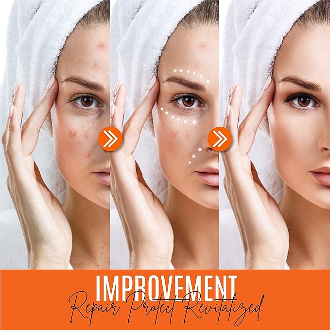30% Organic Vitamin C Serum for Face – Natural Anti-Wrinkle Serum with Hyaluronic Acid & Vitamin E – Anti-Aging Moisturizer for Fine Lines, Dark Spots & Skin Rejuvenation – 2 Fl oz