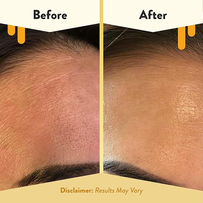 ECZEMA HONEY Concentrated Nighttime Renewal Face Cream - Anti Aging Skin Care Products - Unscented Face Moisturizer for Eczema, Dry & Sensitive Skin (1.7 Oz)