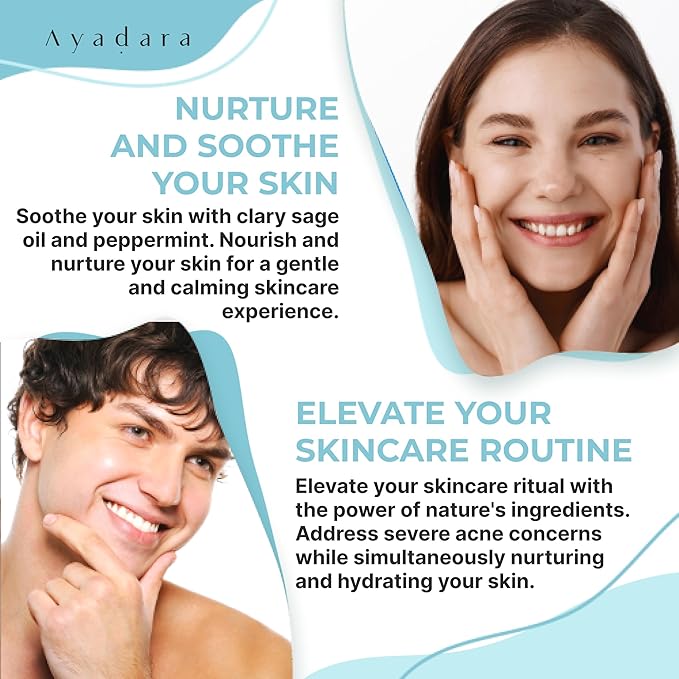 Severe Acne Charcoal Face Wash, 3.4 oz, Daily Cleanser with Sulfur and Honey, Face Cleanser for Acne, Deep Cleansing Charcoal Face Wash for Women and Men, 200 Uses