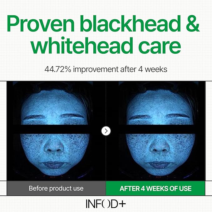 INFODPLUS HydroVita Gel Pad 70 Pads – Exosome & Ceramide Complex | Hydrating, Pore Care, Blackhead & Sebum Control, Soothing Toner Pads