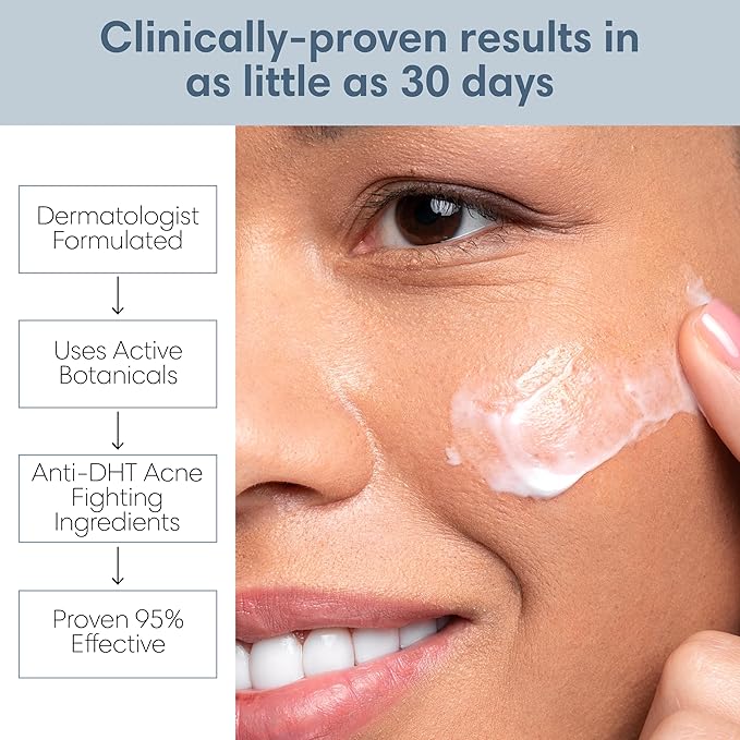 Sensitive Skin Sulfur Acne Lotion, Acne Treatment, Sulfur Cream, Sulfur Ointment, Sulfur Spot Treatment, Sulfur Acne Treatment Cream 1.8 FL Oz
