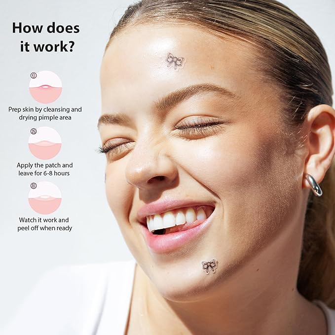 Frilliance Bow Shaped Hydrocolloid Acne Pimple Patches for Zits and Blemishes (Knot Now, 2 Sizes) Spot Treatment Stickers for Face & Skin, Vegan and Cruelty Free