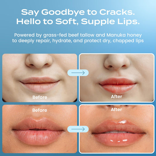 Body Restore Grass Fed Beef Tallow Lip Mask, Manuka Honey – Christmas Stocking Stuffers, White Elephant, Hydrating Moisture, Travel Essentials, Self Care, Birthday Gifts for Women, Men – Peppermint