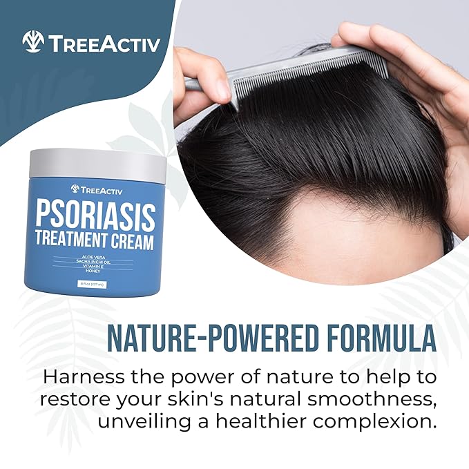 TreeActiv Psoriasis Treatment Cream, 8oz, Psoriasis Cream with Hyaluronic Acid for Face, Scalp, Body, Soothing Cream for Psoriasis Treatment, Psoriasis Moisturizing Cream for Scaly Dry Skin, 500+ Uses