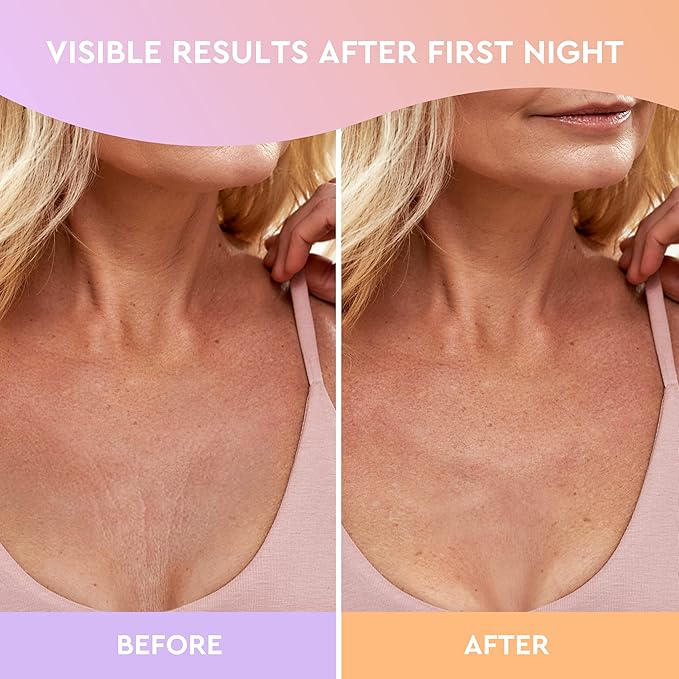 Cleverfy Silicone Chest Wrinkle Pads for Décolleté - 2-Pack of V-Shape Reusable Anti-Wrinkle Patches