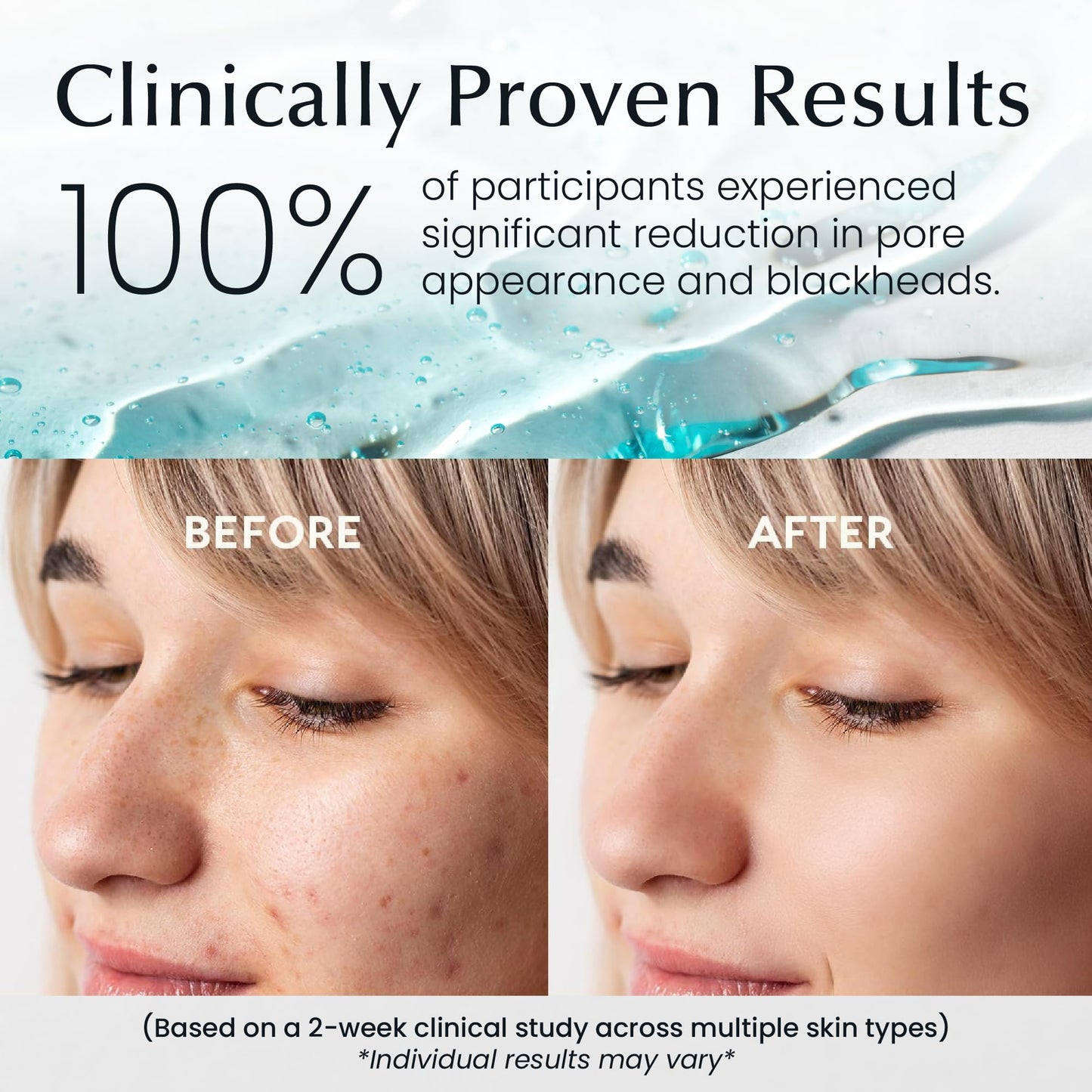 La Pure Korean Toner Pads With Witch Hazel - 100 Ct | Hydrating, Exfoliating Pads & Pore Care Korean Skincare - Gentle, Alcohol-Free, with Glycerin and Centella for Sensitive Skin by La Pure Cosmetics