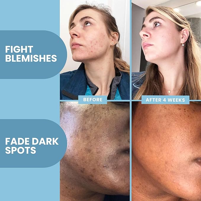 Eva Naturals Vitamin C+ Serum for Face – Anti Aging Dark Spot Remover with Retinol, Hyaluronic Acid, Niacinamide & Salicylic Acid – Face Serum for Women for Clear, Smooth, Radiant Skin