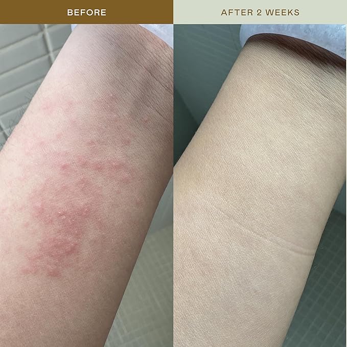 EADEM Mami-Wata Ultra Calming Rescue Mist, Face Mist Hydrating Spray, Hydrating Facial Spray, Barrier Repair Serum, Skin Barrier Serum, Makeup Refresher, 100 ml