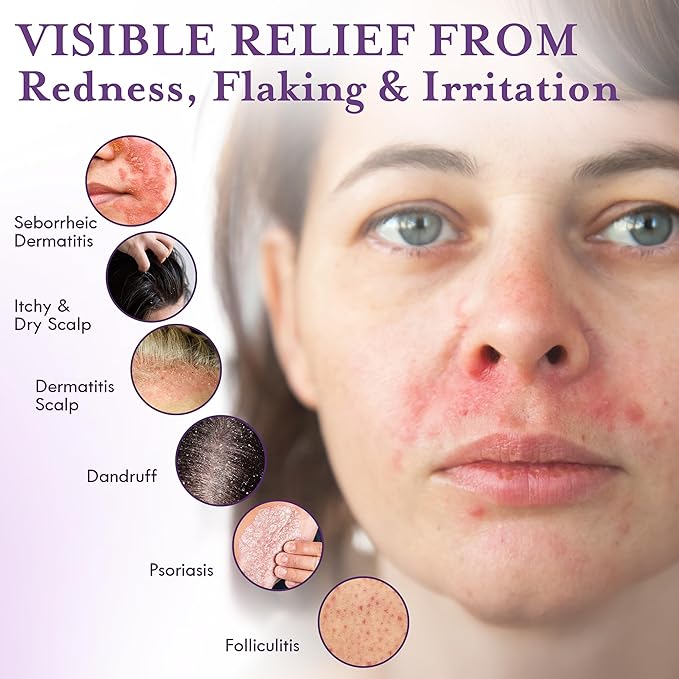 DERMAdoctor Tranquility Cleanser Dermatologist Formulated 2% Pyrithione Zinc for face body & Scalp - 7.10 oz