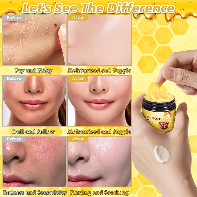 Bee Venom Skin Treatment Cream, 2025 New Professional Bee Venom Repair Cream, Advanced Firming & Wrinkle-Reducing Natural Skin Moisturizer for All Skin Types (2 Bottles)