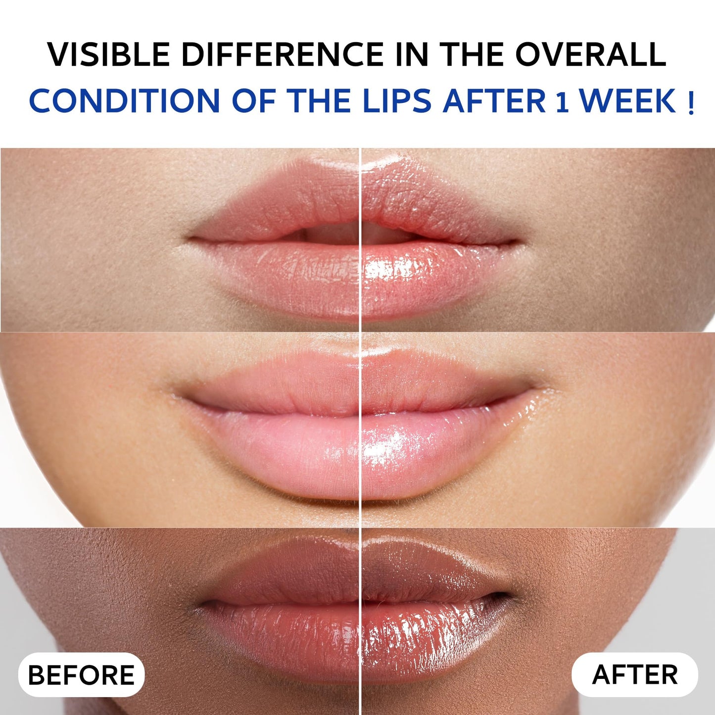 Lip Sleeping Mask (20g), Collagen Lip Mask Overnight, Lip Plumper with Hyaluronic Acid, Peptide Complex Lip Balm for Lip Wrinkle Repair and Plumping, Natural Hydration for Smooth Lips