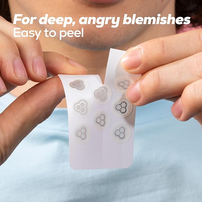Hanhoo EraseZit Magnesium Microneedle Patch, 8 Microneedle Patches, Hydrocolloid Pimple Patches, For Deep Pimples, Calms Angry Zits, Acne Spot Patches, Microdot Pimple Patches, Korean Skincare
