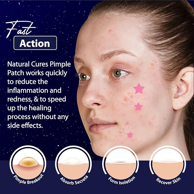 Star Pimple Patches for Face – Hydrocolloid Acne Patches for Quick Zit Relief And Blemishes, Invisible Spot Stickers That Stay All Night, Gentle for All Skin Types, Oil-Free (40 Count)
