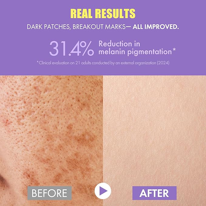 Glutathione Vitamin C Serum 50ml - Step-by-Step Discoloration Correcting Serum with Hyaluronic Acid & Niacinamide - Moisturizing & Hydrating K Beauty Skin Care (1.69 fl oz)