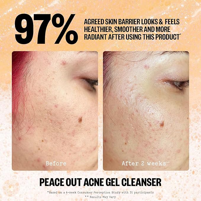 PEACE OUT Skincare Acne Gel Cleanser, Boost Skin Barrier and Help Diminish Blemishes, Daily Acne Face Wash with Salicylic Acid for Men and Women, 4 fl oz