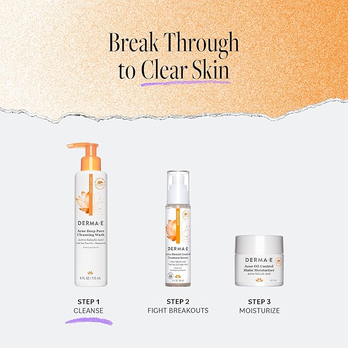 Derma E Acne Deep Pore Cleansing Wash – Blemish Control Facial Cleanser with Salicylic Acid - Gentle Oil Control Face Wash Soothes and Balances Skin, 6 fl oz