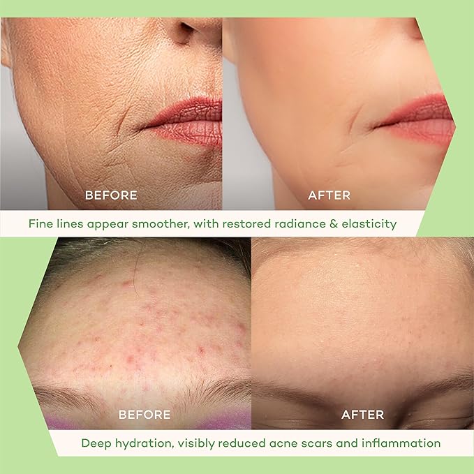 Eternity Oil Face Serum 20ml - Deep Hydration & Soothing for All Skin Types, with Forest Microbes, Squalane and Vitamin E - Revitalizes and Strengthens Skin Barrier