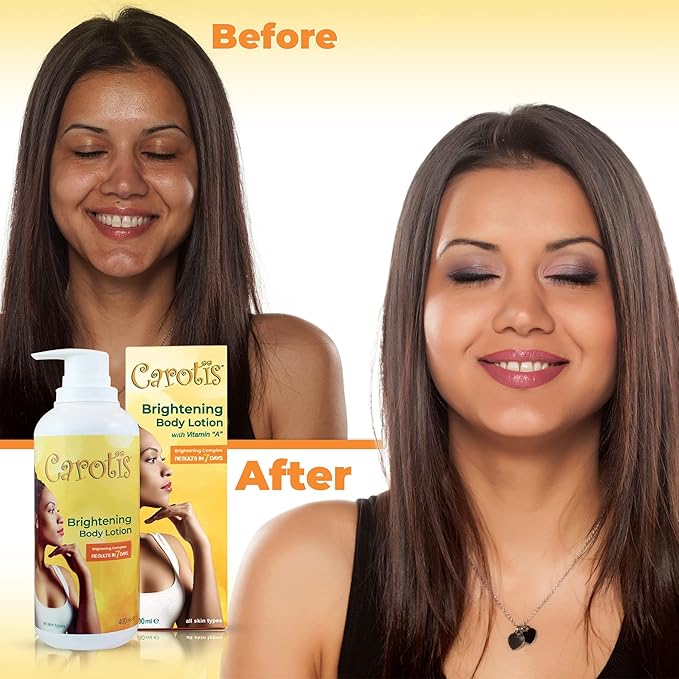 Skin Brightening Lotion - 13.5 Fl oz / 400ml |For Body, Knees, Elbows, Hands, with Carrot Oil and Vitamin A