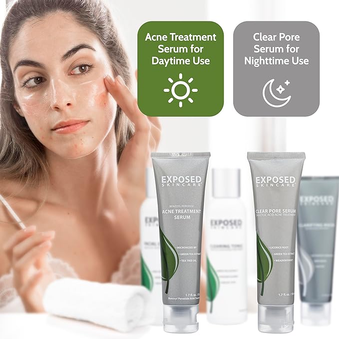 Exposed Skin Care, Acne Treatment Kit with 2.5% Salicylic Acid and 3.5% Benzoyl Peroxide to Clear Up Teen, Adult, Hormonal and Cystic Acne – Natural, Non-toxic and Cruelty Free