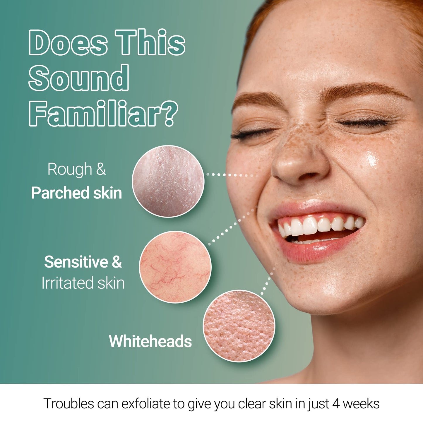 Troubless Clear Whitehead Remover Peel Off Face Mask 5pcs. | Hydrating Face Mask Beauty Sheets Day and Night Moisturizer for Face | White and Blackhead Remover Korean Face Mask Skin Care Peel Off