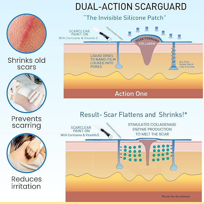 Invisible Brush-On Silicone Sheet with Vitamin E - Scar Removal for Keloids, Burn Scars, Surgery Scars, Stitches, Cuts - No Ugly Scar Sheets, Cream or Messy Scar Gel Needed