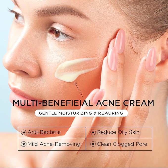 Acne Treatment for Face: Cystic Acne Spot Control Cream with Salicylic Acid & Tea Tree Oil for Blemishes - Gentle Hormonal & Pimple Treatment for Teens & Adults - 120 Day Supply & 3.38oz