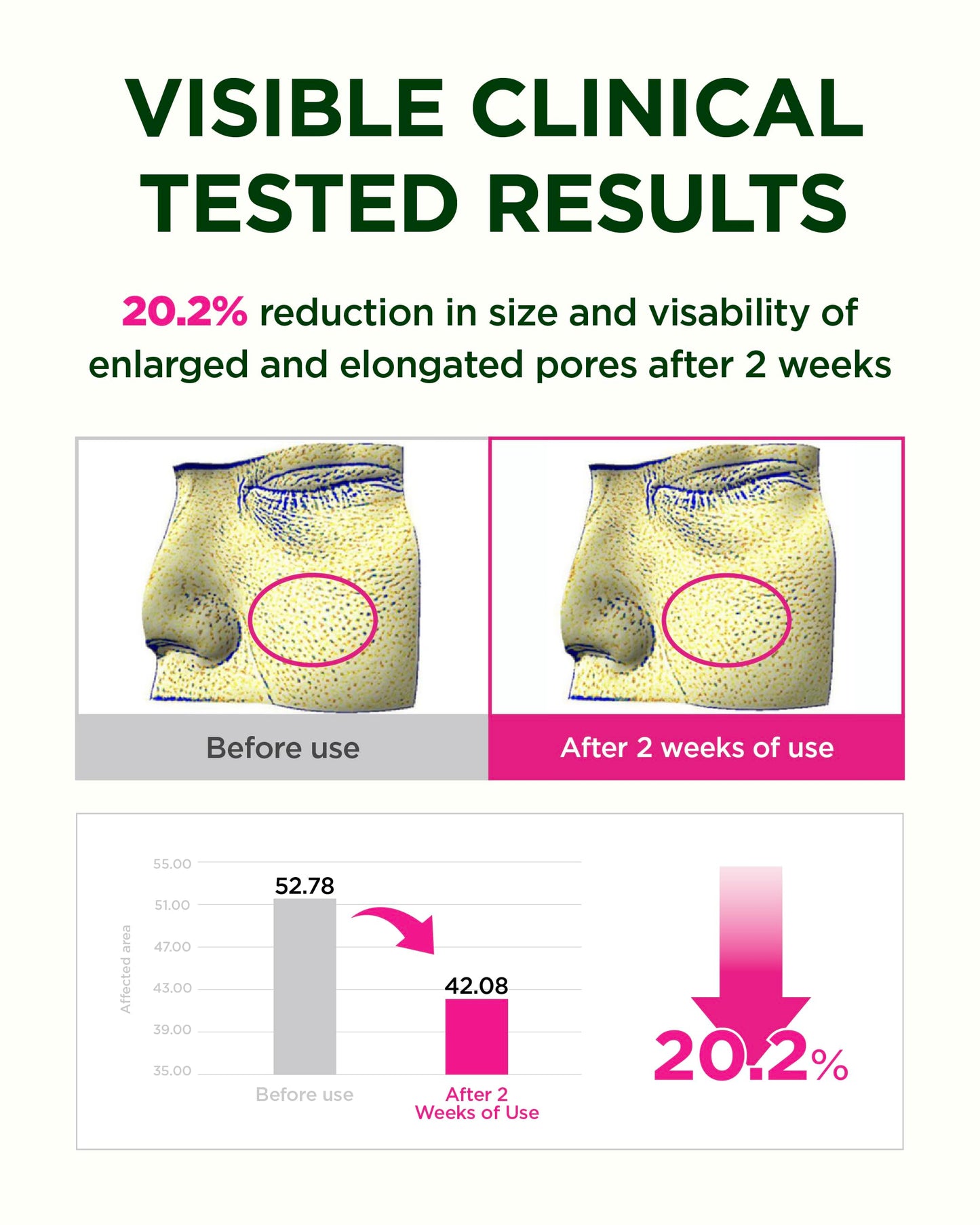 CKD Retino Collagen Boosting Hydrogel Face Mask (1ea) - Korean Overnight Jelly Mask for Glass Skin, Deep Moisturizing, and Pore Minimizing with Retinal & Low Molecular Collagen. Korean Skin Care