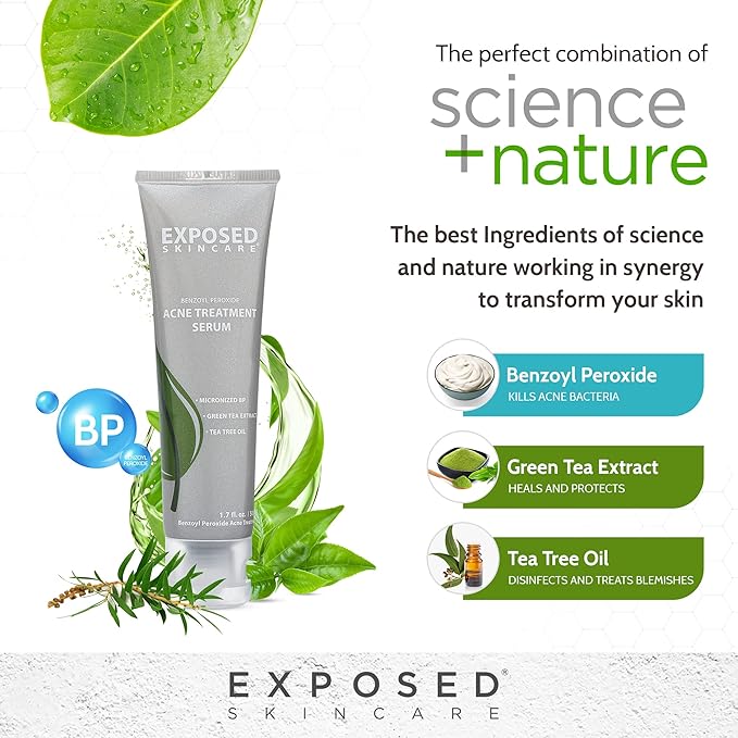 Exposed Skin Care Acne Treatment Serum – Lightweight Acne Spot Treatment with Micro Benzoyl Peroxide, Green Tea & Tea Tree Oil, Quickly Clears Pimples and Breakouts, 2.7 Fl Oz