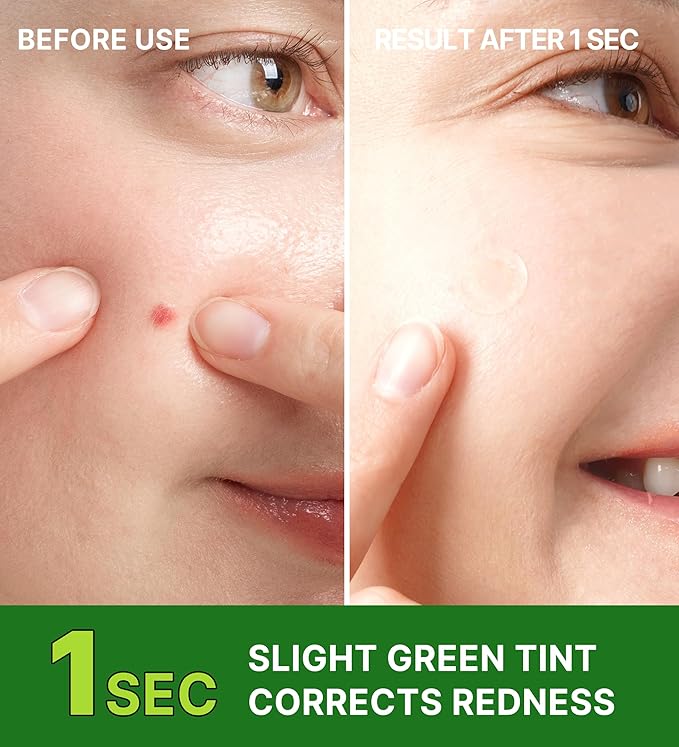 Troubless Invisible Plus Spot Patch The Red Correct - Thin Hydrocolloid w/ 98% Tea Tree Extract for Redness - High-Absorption, Seamless Adhesion & Easy-Wear Zit Patches for Face (96 ea)