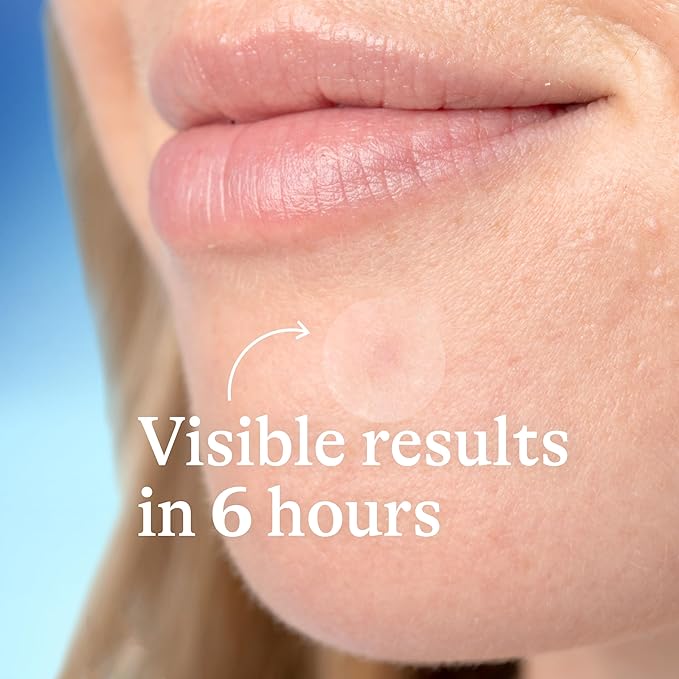 Differin Acne Patches, Pimple Patches for Acne Prone Skin, Formulated with Salicylic Acid and Centella, Fast Triple Action Power Patch for Day & Night, Dermatologist Tested, 36 Count