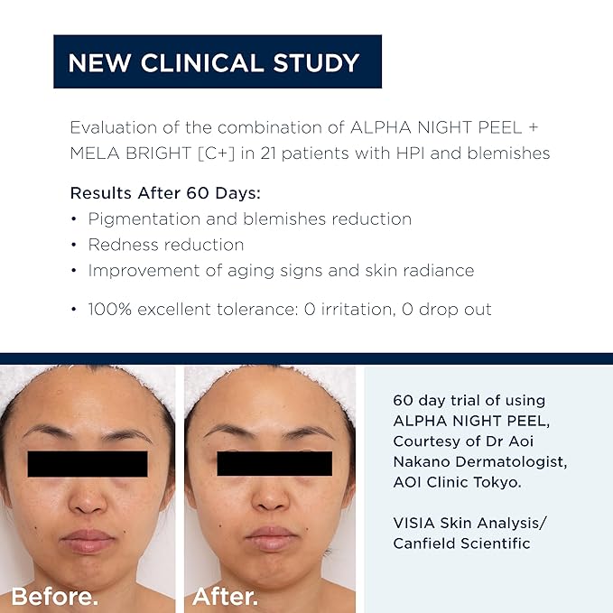 ALPHASCIENCE Mela Bright [C+] Serum - Helps Enhance Skin - Protect Skin's Barrier - Pro-Collagen Action - with Stable Cysteamine, 30 ml / 1 fl. oz.