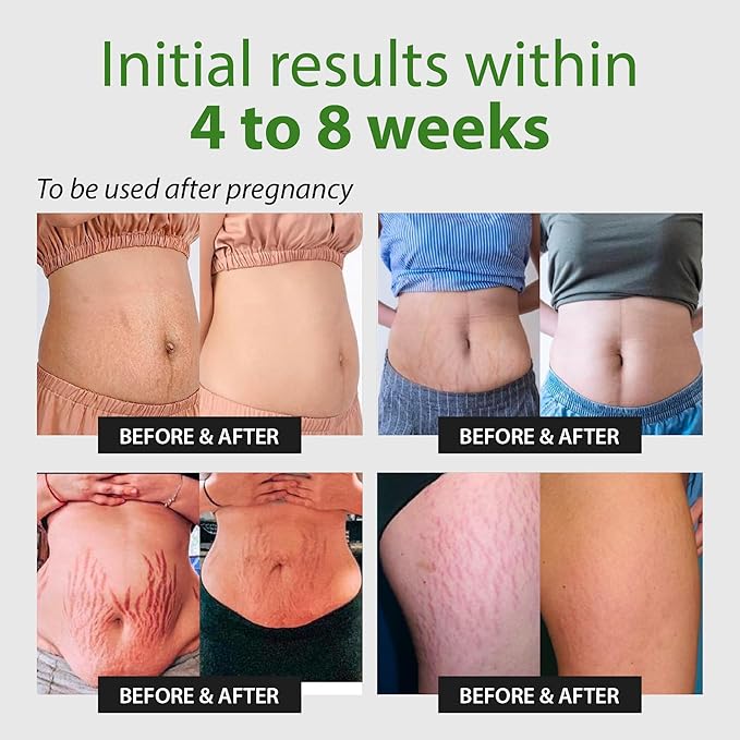 Abera Ovela Maternity Stretch Mark Cream oz