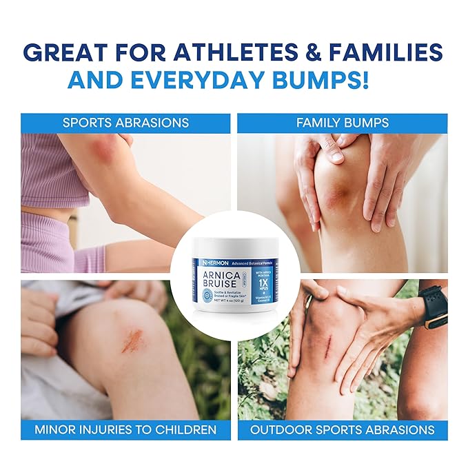 Hermon Arnica Bruise Cream Extra Strength: Fast-Acting for Bruising & Swelling on Thin Skin - High Strength Arnica Montana with Vitamins K, C & E–Hydrating Moisturizer for Face (4 oz(pack of 1))