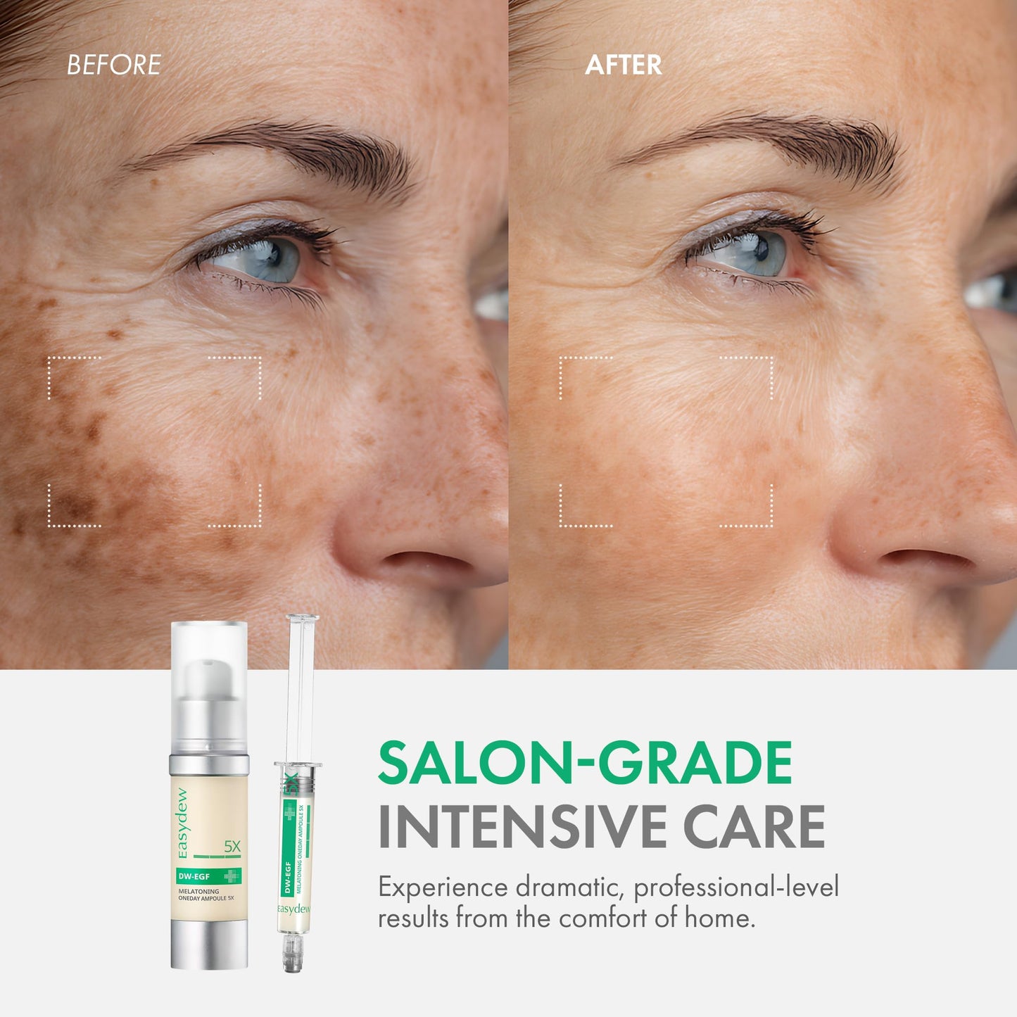 Easydew DW-EGF Melatoning Ampoule 5X - Hydrating Dark Spot Serum with Niacinamide & Glutathione for Uneven Patches - Fast Absorbing Day & Night Ampoule Korean Skin Care (Bottle 1.01 fl oz, EGF 5X)