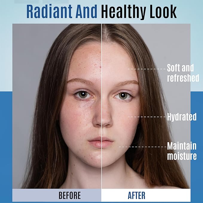 Hyaluronic Acid Moisturizer - Hydrating Moisturizer Face Cream to Reduce Pigmentation & Improve Skin Elasticity - Anti Aging Cream for Day and Night Use - Suitable for All Skin Types - 50 ml