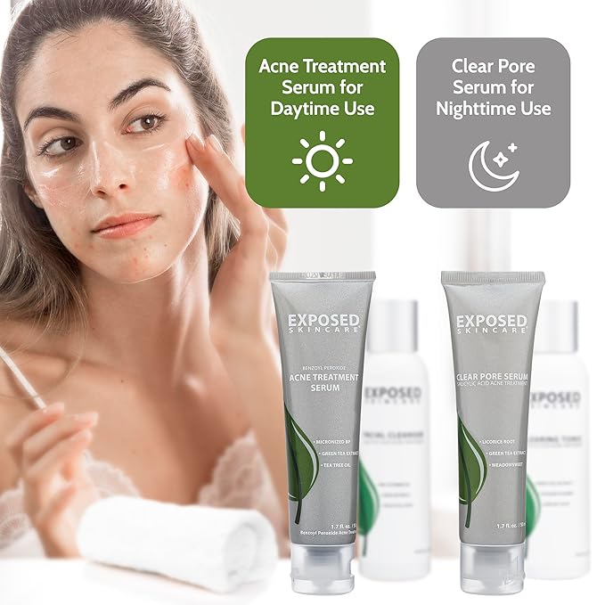 Exposed Skin Care, Basic Acne Treatment Kit with 2.5% Salicylic Acid and 3.5% Benzoyl Peroxide to Clear Up Teen, Adult, Hormonal and Cystic Acne – Natural, Non-toxic and Cruelty Free