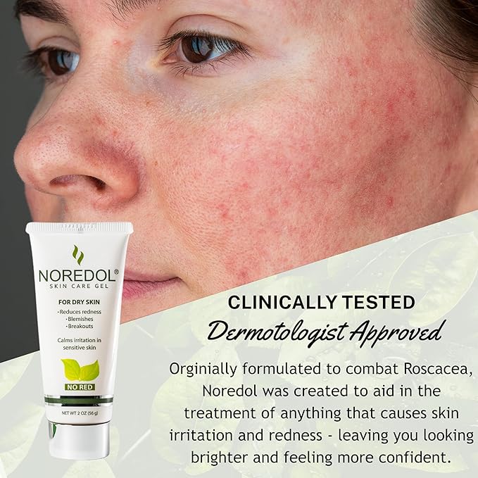 Skin Care Gel - Redness Relief Moisturizer for Dry Skin - Rosacea Treatment for Face - Soothes Prone Skin and Irritation - Fragrance Free 1 oz.